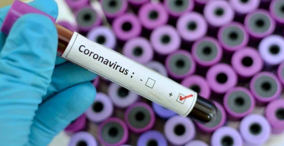 Coronavírus: Bunge suspende viagens de funcionários à China