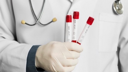 Mafrig diz que fará testes de Covid-19 em todos os seus funcionários