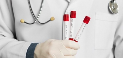 BRF aplica testes de coronavírus em seus trabalhadores