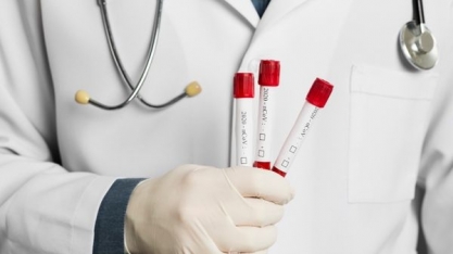 BRF aplica testes de coronavírus em seus trabalhadores