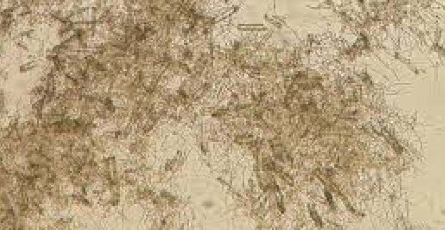 Coquetel enzimático potencializa produção de etanol de segunda geração